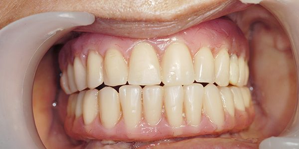 Imagen-de-Caso-1baja